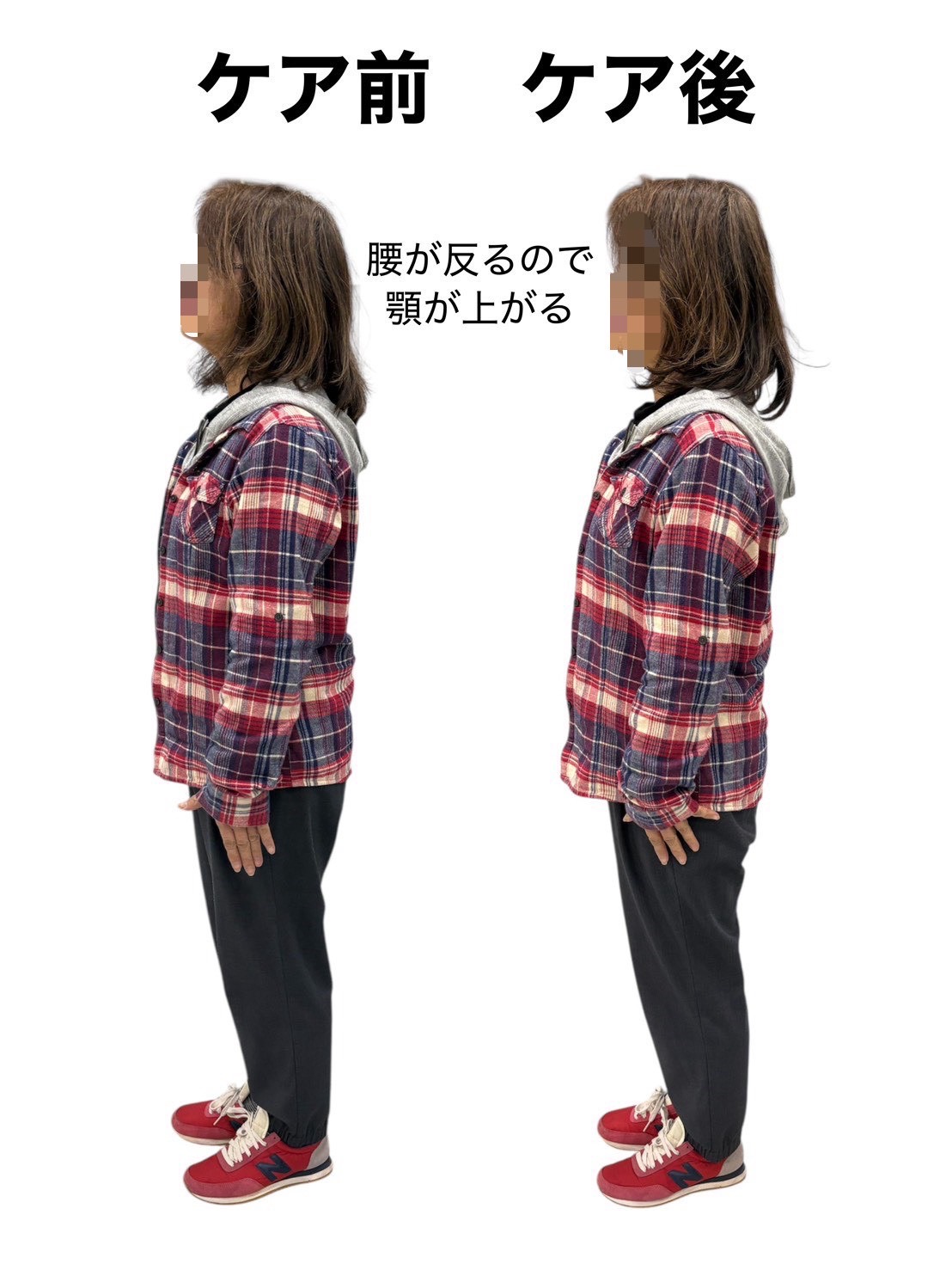 症例 3