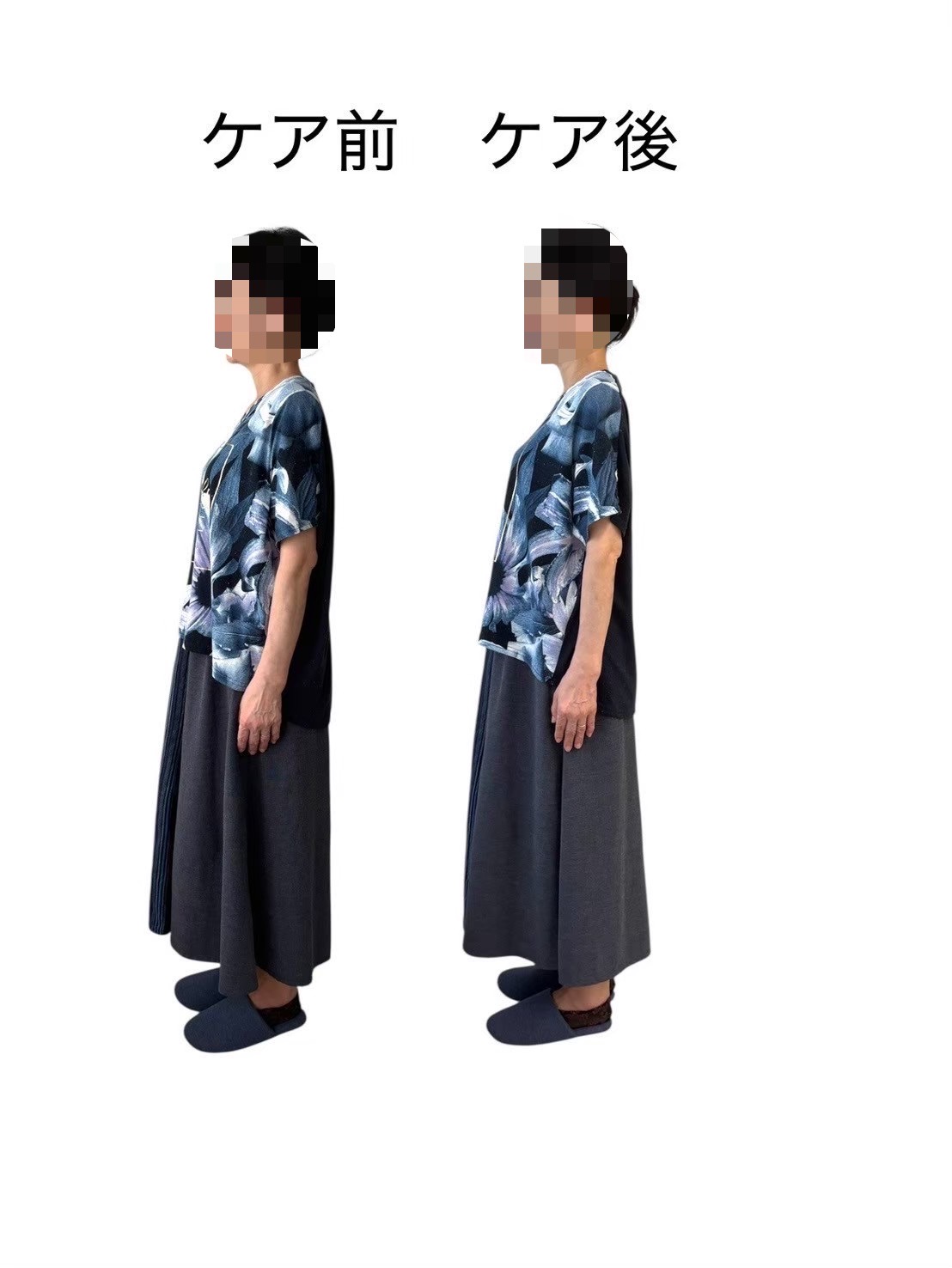 症例 5
